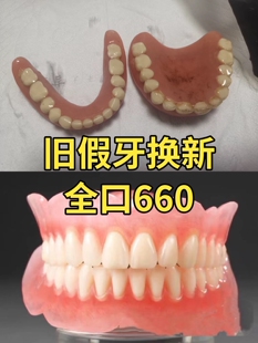 旧牙换新 功能义齿半口老人活动假牙活动牙