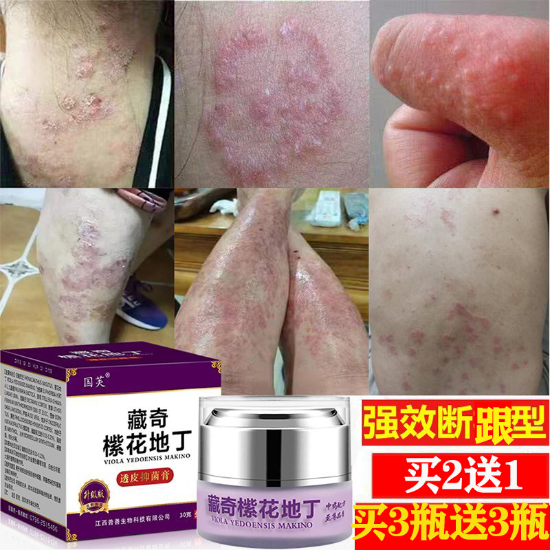 藏奇紫花地丁药膏透皮抑菌膏官方旗舰店正品白花地丁肤毒清止奇痒