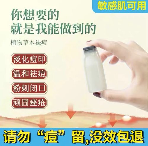 小白瓶神器去除闭口正品祛痘膏