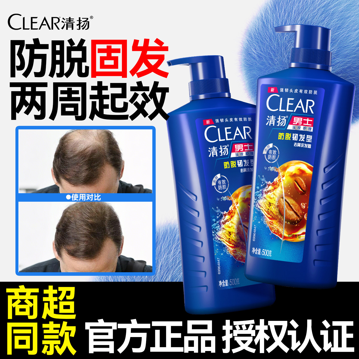 清扬防脱固发洗发水男士控油去屑固发生发露液官方品牌正品旗舰店