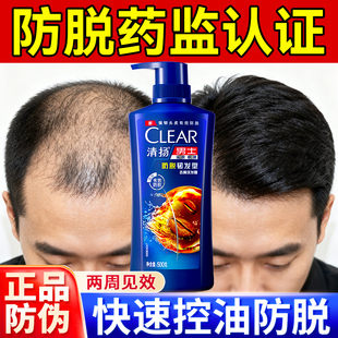 清扬防脱发洗发水控油蓬松型男士用养发固发生发排行榜第一名头膏