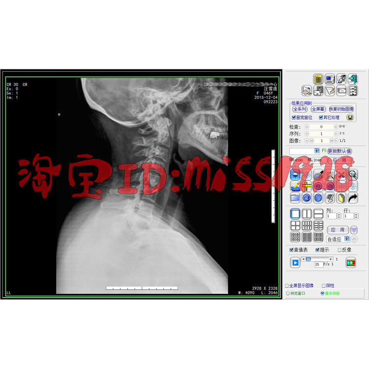 CT影像工作站DR工作站CR软件MR软件PACS系统胃肠C臂工作站DSA软件
