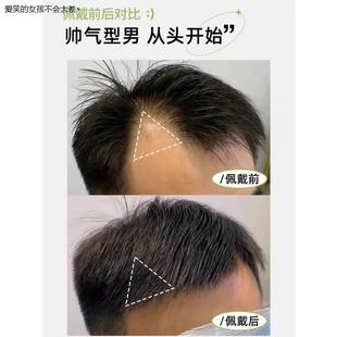 鬓角补发片贴真发无痕隐形假发片前额遮盖两鬓角补发隐形男LHAL4