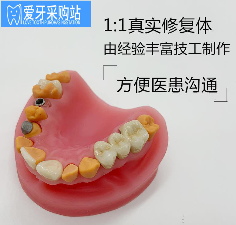 硅胶仿真舌头高端修复体展示模型