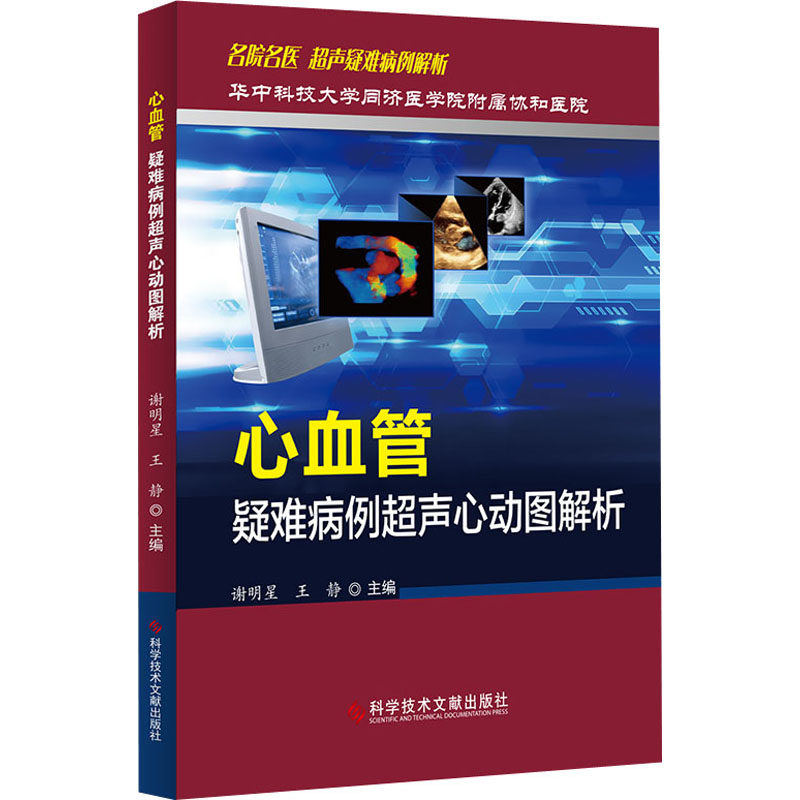 超声心动图解析 谢明星,王静 编 影像医学生活 新华书店正版图书籍