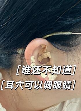 已然眼动力釜翔视力中医耳穴压豆磁珠疗贴近远弱调理舒缓放松调节