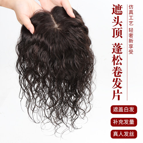 头顶补发片女头发稀少