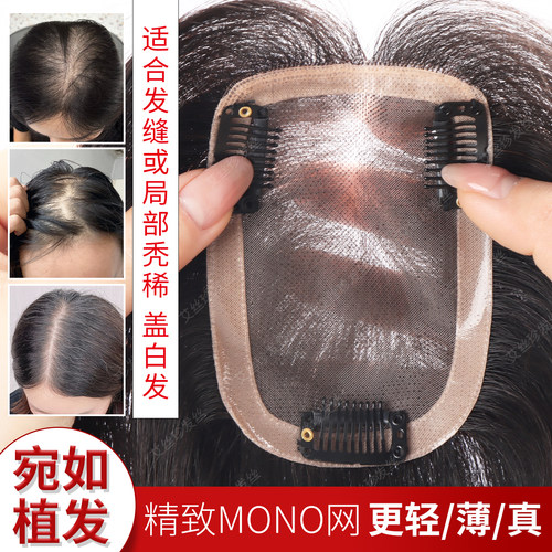 夏季透气真发丝遮白发补发片