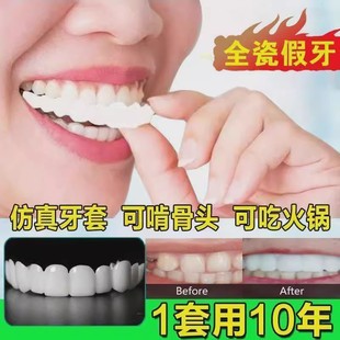 牙套吃饭神器 老人男女通用塞牙缺牙美白假牙套牙仿真 牙齿贴片
