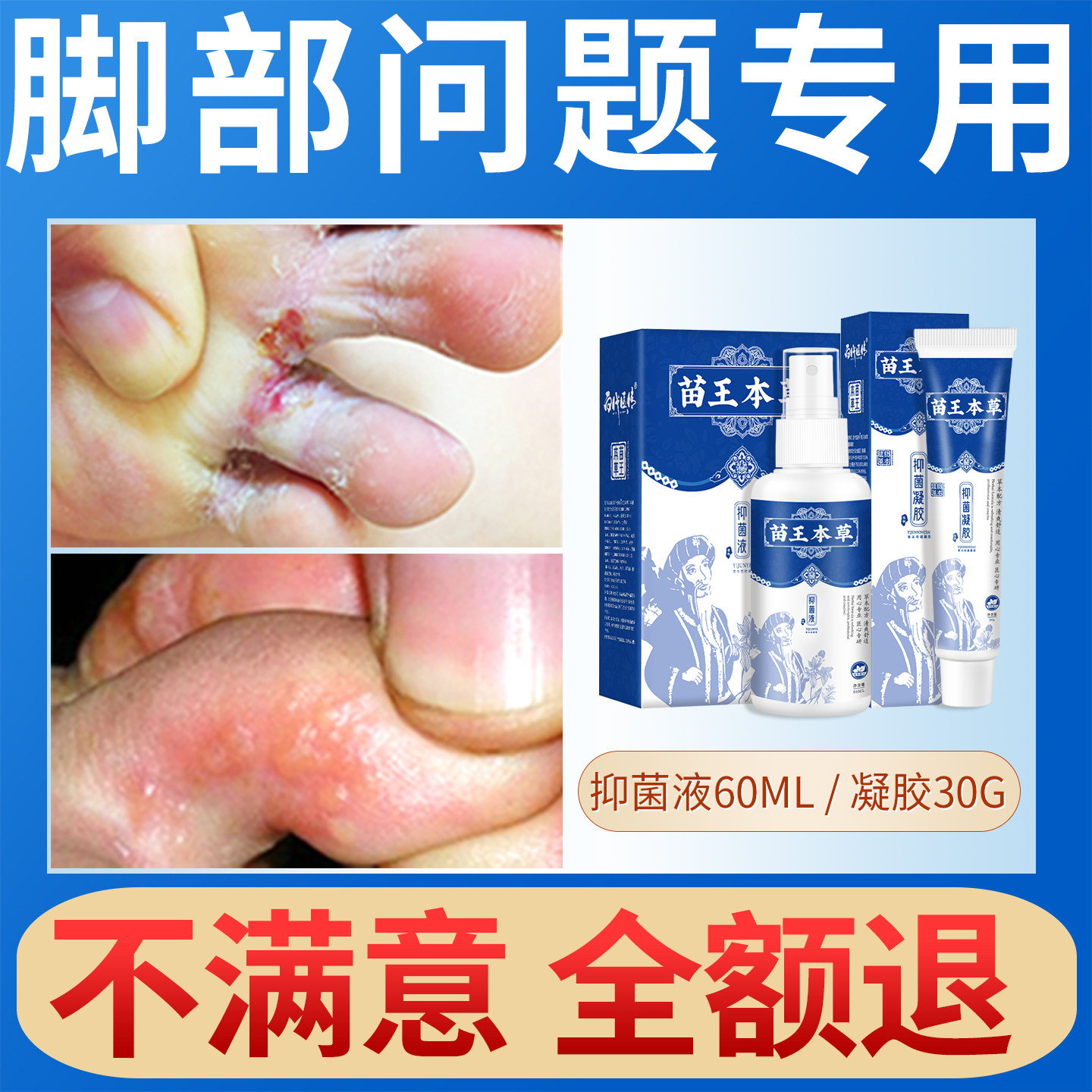 苗王本草喷剂去烂脚丫糜烂水泡脚气止痒脱皮杀菌真菌感染专用神器
