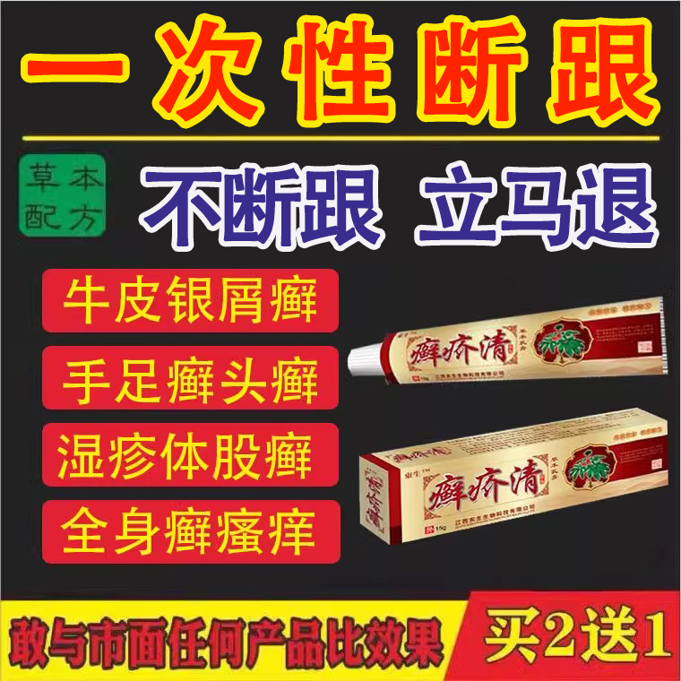复方黄柏祛癣搽剂治疗牛皮癣银屑病瘙痒止痒湿疹根去除股体藓药膏