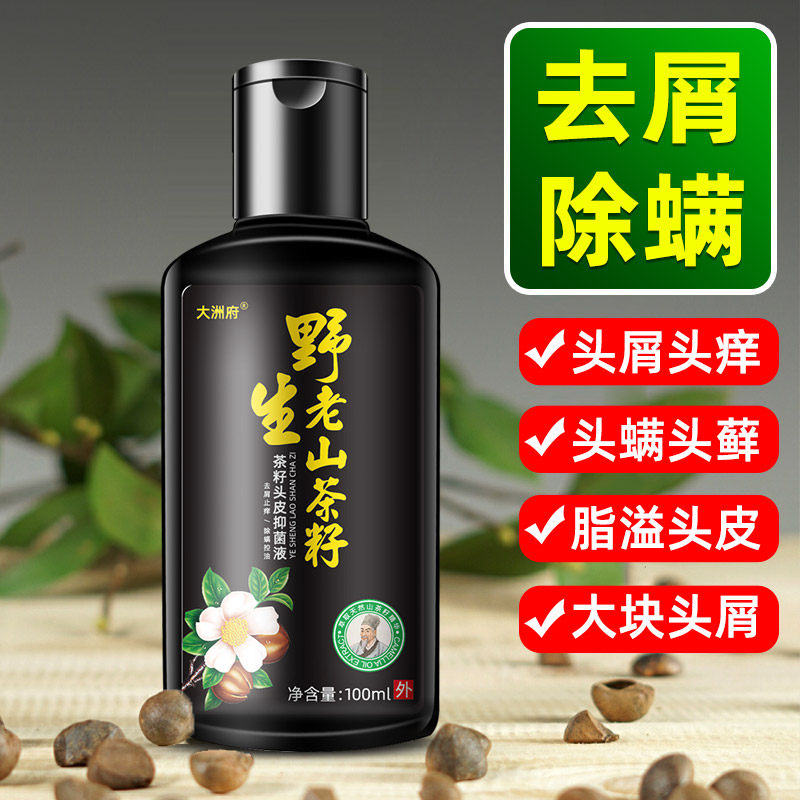 去头藓头皮癣真菌洗发水去屑止痒大块头屑洗发露控油除螨虫洗头膏