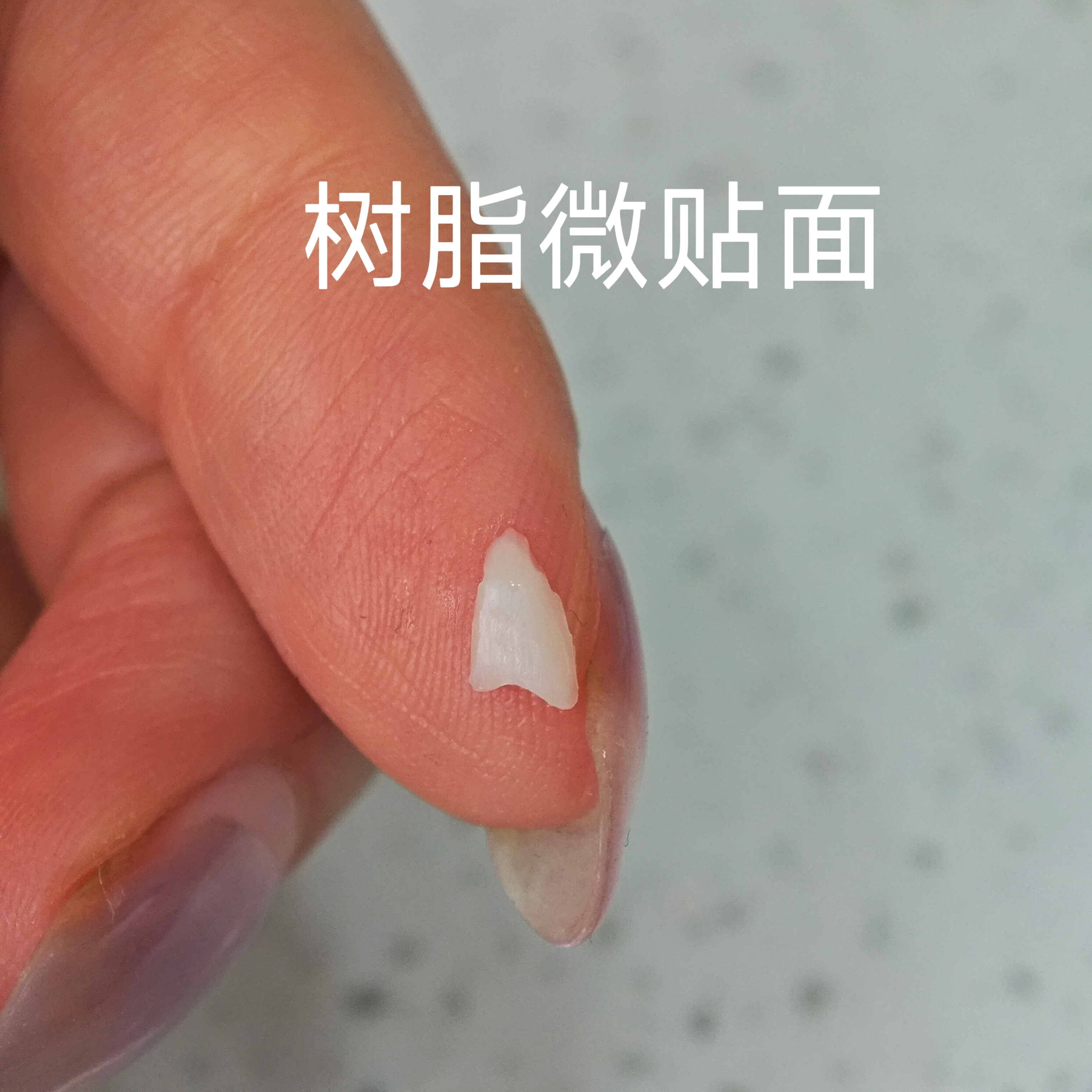 隐形美牙贴片贴面 牙套 牙齿黄内凹缺牙 美白遮挡牙贴片门牙遮挡