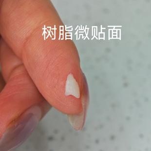 隐形美牙贴片贴面 牙套 牙齿黄内凹缺牙 美白遮挡牙贴片门牙遮挡