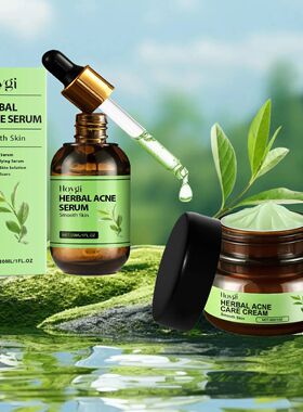 Acne Face Cream Pimple Treatment Oil Control Repair Redness