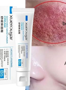 Instant Rosacea Treatment Face Cream Repair Redness Dry Sens