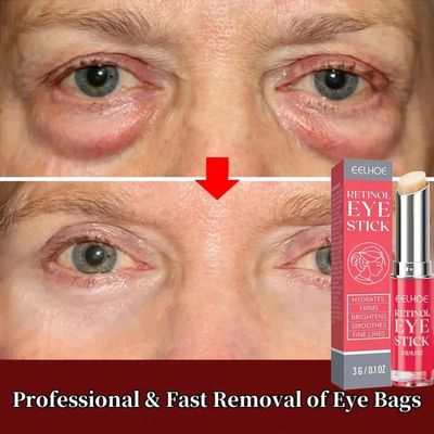 Retinol Eye Bags Cream Anti Dark Circles Instant Wrinkle Rem