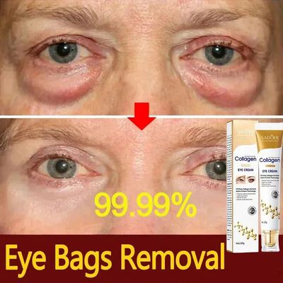 Instant Eye Bag Removal Cream Collagen Anti-Wrinkle Firming