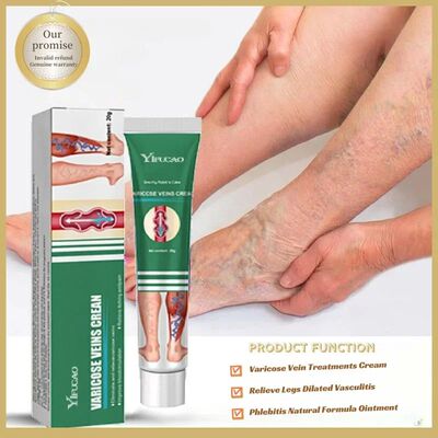 Varicose Vein Treatments Cream Effective Relieve Legs Dilate