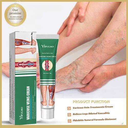 Varicose Vein Treatments Cream Effective Relieve Legs Dilate