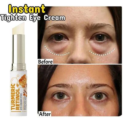 Instant Eye Bag Remove Eye Cream Anti Fat Particles Dark Cir