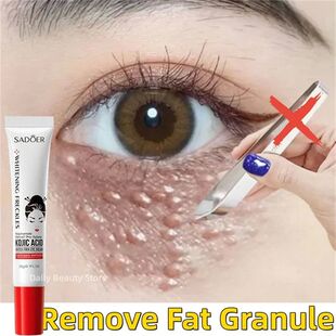 Fat Granules Remover Eye Cream Anti-Puffiness Anti Inflammat