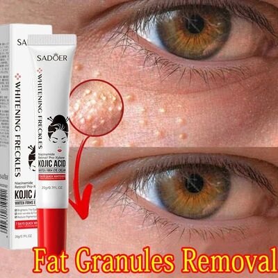Fat Granules Remover Eye Cream Anti-Puffiness Anti Inflammat