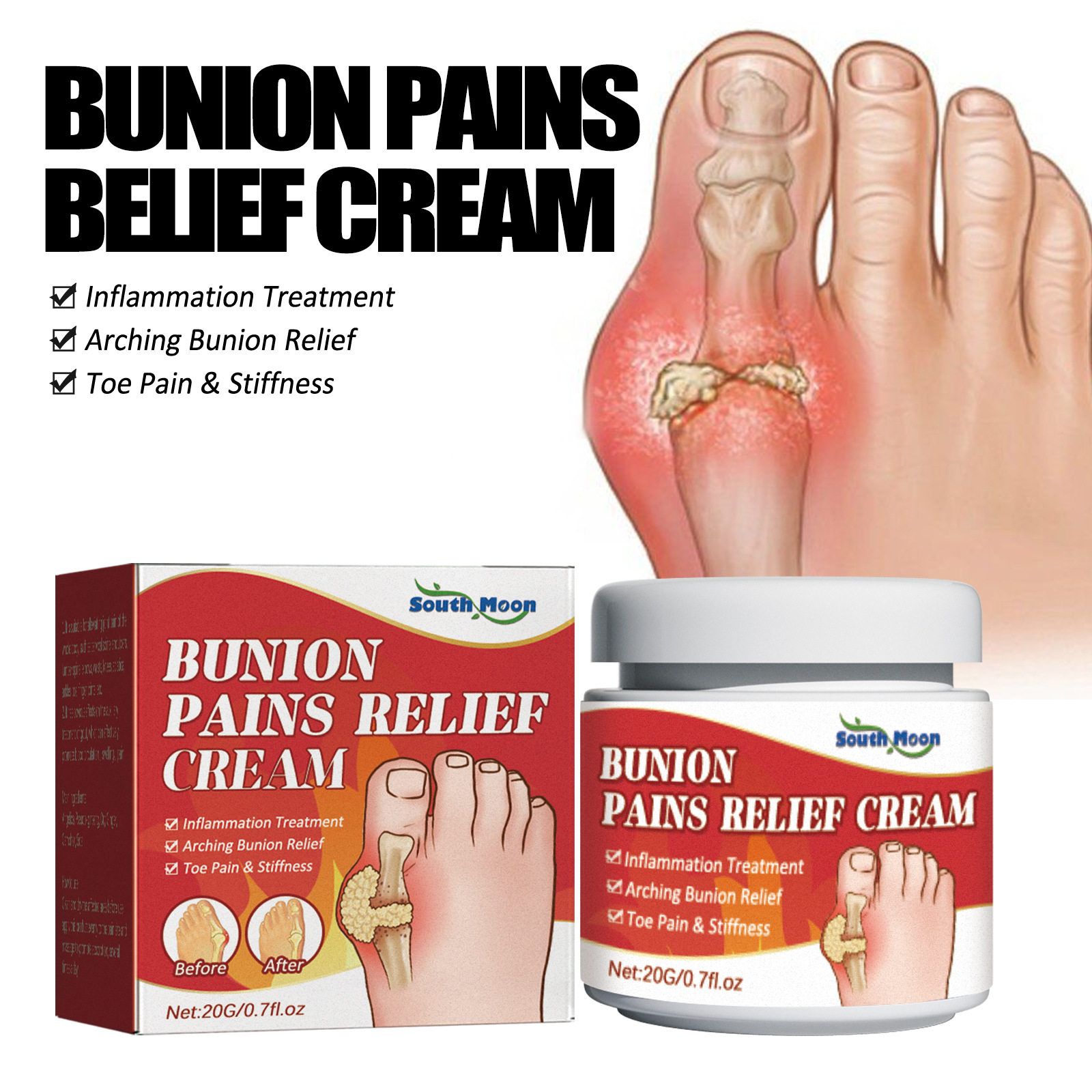 Bunion joint ointment to relieve the pain of thumb joint图片
