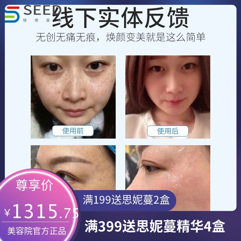 5G黑科技无创祛斑仪磁波扫斑仪脸部无痕扫斑毛孔取斑秒斑王美容院