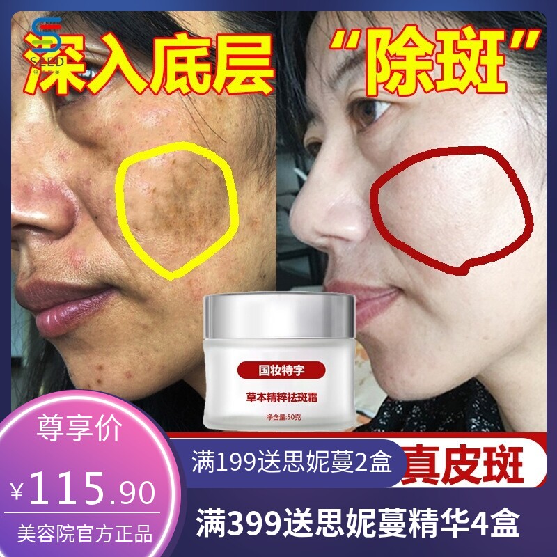 祛斑霜美白去黑色素源头去老年斑去雀斑黄褐斑色斑早晚强效炸斑霜