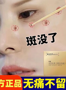 点斑祛斑专用药水精华液分解黑色素不留疤去斑黄褐斑雀斑官方正品