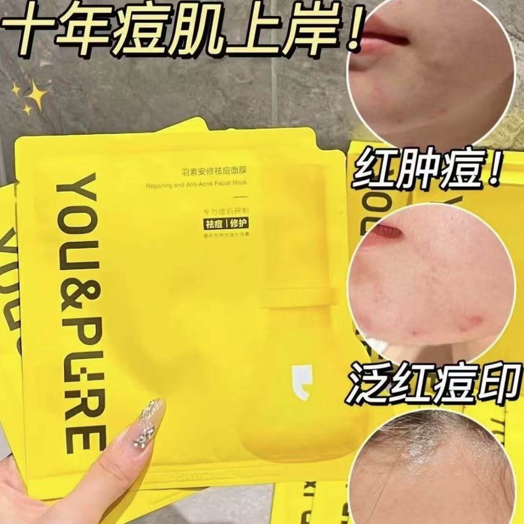 羽素【大灯泡面膜】祛痘面膜舒缓淡红无酸保湿修护调理痘肌正品