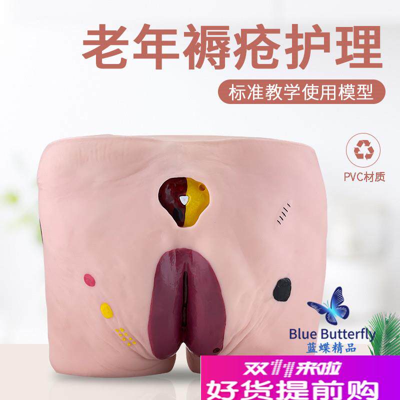 褥疮模型压疮伤口模型高级老年人压疮褥疮仿真护理X模型医教学用