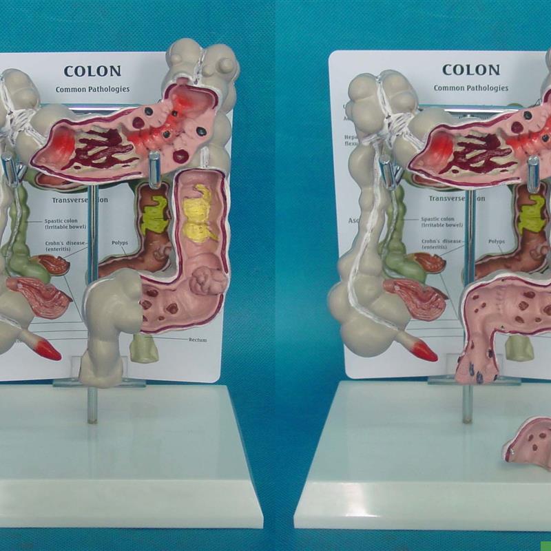 人体十二指肠消化系统解剖模型医用医学I教学教具厂家直销大肠病