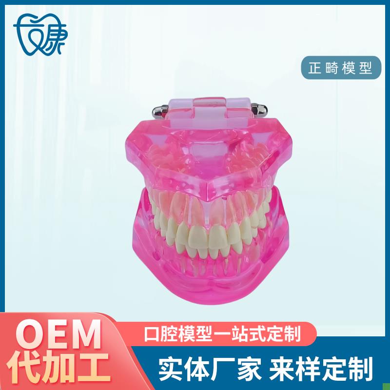 牙齿模型病理修复可拆卸正畸口腔病理牙模型牙科X医患活动沟通