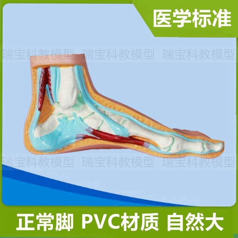 人体脚解剖模型正常与畸形扁平足B弓形踝关节脚骨关节仿真1:1比例