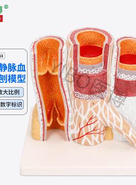 医博BIX-A3443动脉静t脉血管解刨模型人体血管解刨放大模型血管切