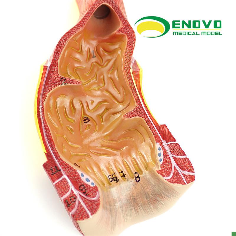ENOVOe颐诺医学人体直肠肛管肛门解剖结构模型肛肠科外科普外科