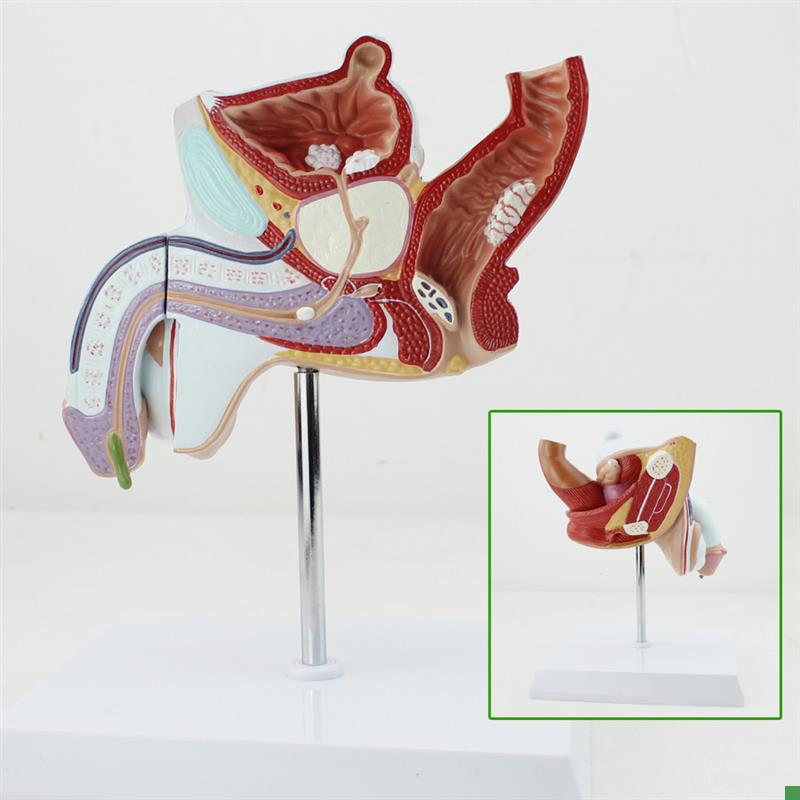 颐诺正品人体男性生殖泌尿疾病模型男I科模型淋病前列腺增生模型