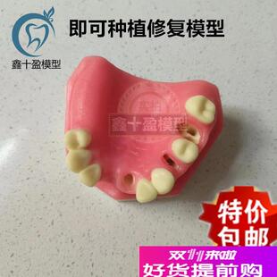 口腔种植练习模型上颌骨上颌窦牙列缺失种植体齿科牙齿模型XPIM-2