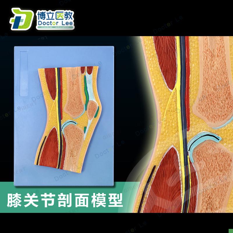 CT髋关节切面浮雕髋关v节断层解剖学模型脚运动解剖学模型