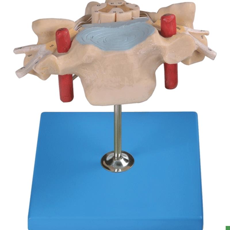 颈椎附脊髓和脊神经y放大模型A18105