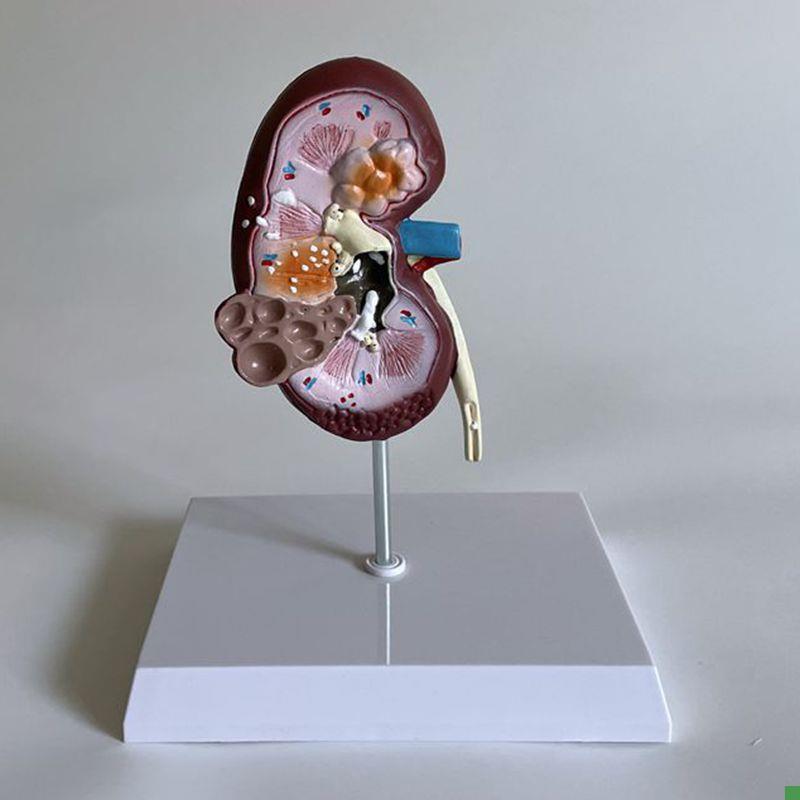 康泰模型a犬肾脏泌尿系统内脏囊病理兽医药促销动物医院宠物狗标