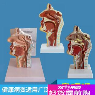 鼻咽喉模型鼻f腔分泌物额窦口腔牙齿舌咽耳鼻喉医药促销扁桃体病