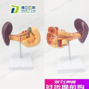 脾胰十二指肠模型胰腺模型脾脏模型肝胆P胰腺消化科教学模型