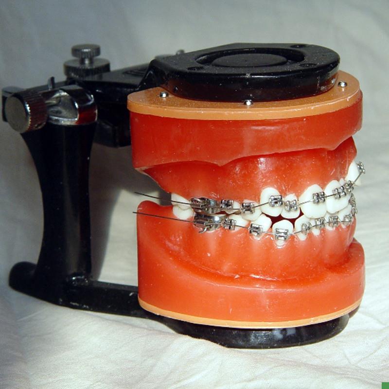 ENOVO颐诺正F畸矫正练习模型