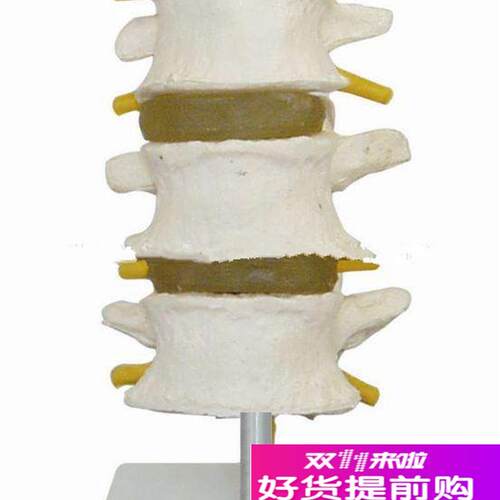 正常腰椎模型(四节)腰椎模型J骨骼模型人体腰椎模型
