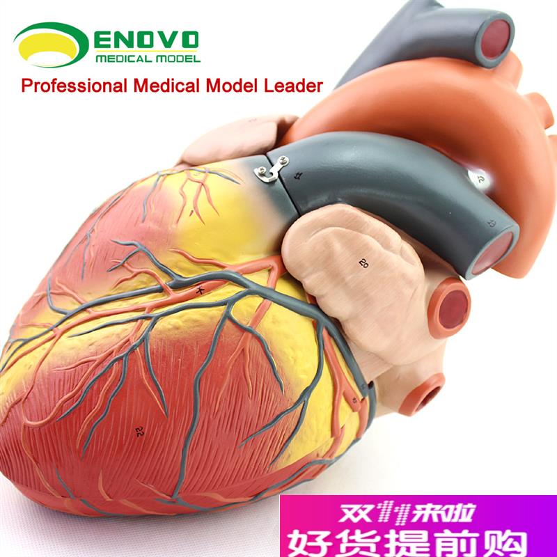 颐诺正品放大人体心脏模型Bx超彩超声医用心内科心脏解剖教学模型