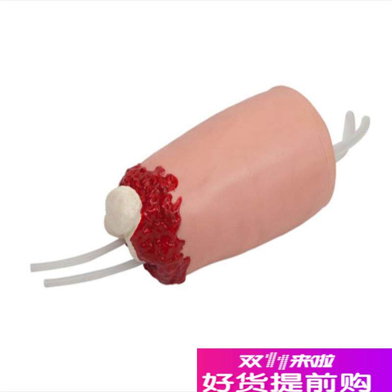 下肢外伤断肢止血模型