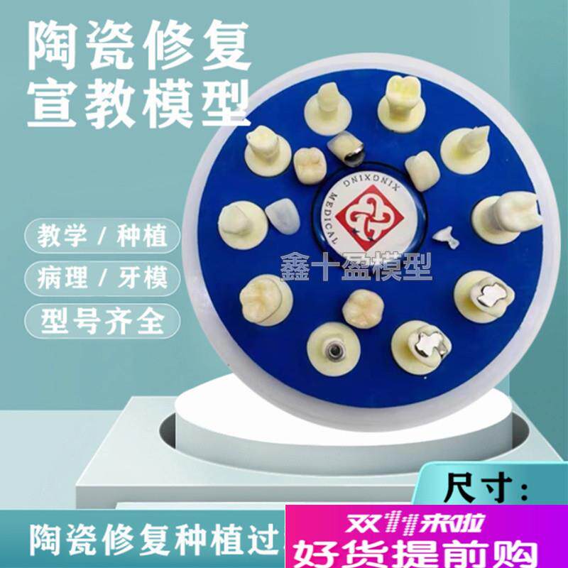 牙齿模型口腔教学陶瓷10*w1仿真修复治疗过程种植根管病理医患沟